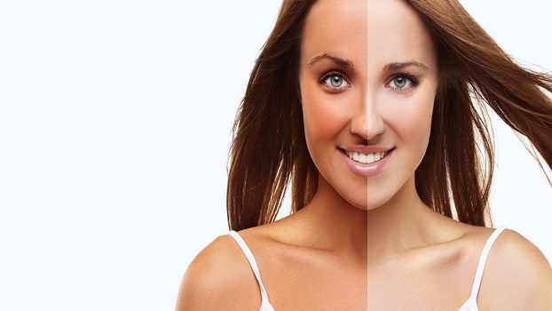 How to remove sun tan fast!